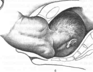   2     Antiembolic  stockings 173396566   6 016   - Wildberries